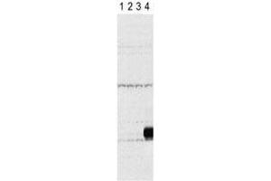 Western blot testing of Aurora-C antibody and lysate of 293 cells expressing Flag tag (lane 1), Flag-tagged Aurora-A (2), -B (3), -C (4). (Aurora Kinase C anticorps  (AA 3-38))