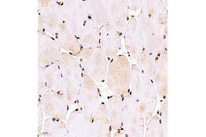 Immunohistochemistry of paraffin embedded mouse Skeletal muscle using ZNF498 (ABIN7076253) at dilution of 1:700 (400x lens)