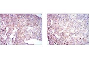 Immunohistochemistry (IHC) image for anti-Coactosin-Like Protein antibody (ABIN1106731)