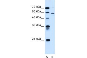Western Blotting (WB) image for anti-Asparagine-Linked Glycosylation 11, alpha-1,2-Mannosyltransferase Homolog (Yeast) (ALG11) antibody (ABIN2462823) (ALG11 anticorps)
