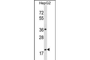 M1M Antibody (Center) (ABIN1537819 and ABIN2848601) western blot analysis in HepG2 cell line lysates (35 μg/lane). (PPM1M anticorps  (AA 130-158))