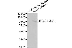 Western Blotting (WB) image for anti-V-Raf-1 Murine Leukemia Viral Oncogene Homolog 1 (RAF1) (pSer621) antibody (ABIN3019551) (RAF1 anticorps  (pSer621))