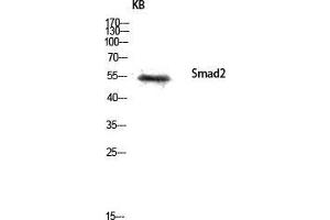 Western Blot (WB) analysis of KB lysis using Smad2 antibody.
