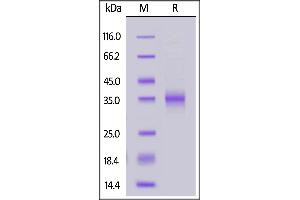 Biotinylated SARS-CoV-2 S protein RBD (K417T, E484K, N501Y), His,Avitag on  under reducing (R) condition.