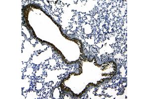 IHC analysis of Uteroglobin using anti-Uteroglobin antibody .