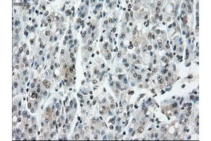 Image no. 19 for anti-P450 (Cytochrome) Oxidoreductase (POR) antibody (ABIN1497746) (POR anticorps)