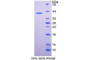 SDS-PAGE (SDS) image for Chemokine (C-X-C Motif) Ligand 11 (CXCL11) (AA 22-94) protein (His tag,GST tag) (ABIN1981055)