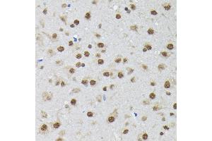 Immunohistochemistry of paraffin-embedded rat brain using PTBP2 Rabbit pAb (ABIN6128372, ABIN6146373, ABIN6146374 and ABIN6221684) at dilution of 1:100 (40x lens). (PTBP2 anticorps  (AA 1-280))