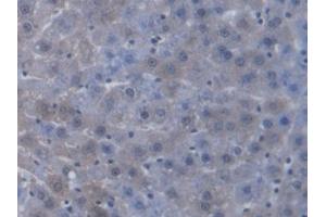 DAB staining on IHC-P; Samples: Rat Liver Tissue (TAP2 anticorps  (AA 467-703))