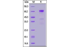 Biotinylated Human Glypican 3, His,Avitag on  under reducing (R) condition.