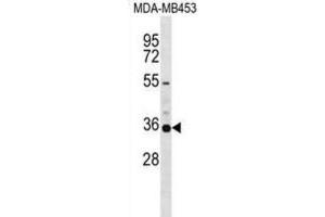 Western Blotting (WB) image for anti-Potassium Voltage-Gated Channel, Shaker-Related Subfamily, Member 5 (KCNA5) antibody (ABIN2999168) (KCNA5 anticorps)