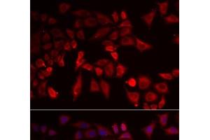 Immunofluorescence analysis of MCF-7 cells using PYGL Polyclonal Antibody (PYGL anticorps)