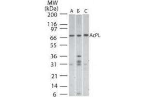 Image no. 1 for anti-Interleukin 18 Receptor Accessory Protein (IL18RAP) (AA 50-100) antibody (ABIN199977) (IL18RAP anticorps  (AA 50-100))