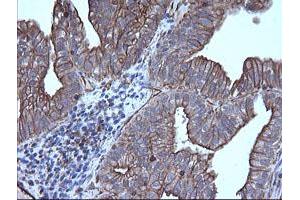 Image no. 3 for anti-Tripartite Motif Containing 38 (TRIM38) (AA 1-265) antibody (ABIN1490685) (TRIM38 anticorps  (AA 1-265))