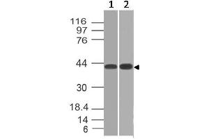 Image no. 1 for anti-Cytokine Receptor-Like Factor 2 (CRLF2) (AA 97-252) antibody (ABIN5027607) (CRLF2 anticorps  (AA 97-252))