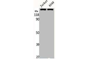 Western Blot analysis of Jurkat A549 cells using MRP7 Polyclonal Antibody