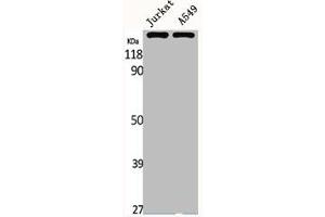 Western Blot analysis of Jurkat A549 cells using MRP7 Polyclonal Antibody (ABCC1 anticorps  (Internal Region))