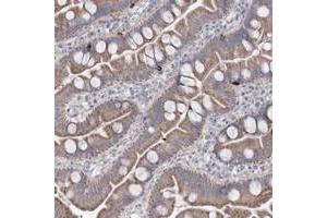 Immunohistochemical staining of human small intestine with MTCH2 polyclonal antibody  shows moderate cytoplasmic positivity in glandular cells. (MTCH2 anticorps)