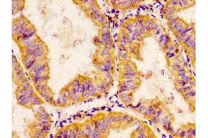 anti-Chordin-Like 1 (CHRDL1) (AA 92-237) antibody