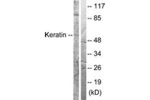 Western blot analysis of extracts from HeLa cells, treated with Anisomycin 25ug/ml 30', using Keratin 8 (Ab-73) Antibody. (KRT8 anticorps  (AA 41-90))