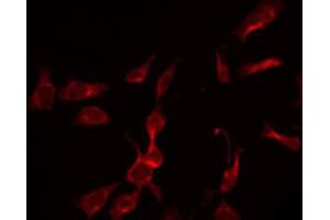 ABIN6266936 staining K562 by IF/ICC.