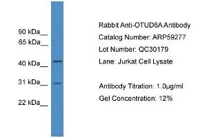 WB Suggested Anti-OTUD6A  Antibody Titration: 0.
