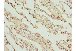 Immunohistochemistry of paraffin-embedded human lung tissue using ABIN7154146 at dilution of 1:100 (GLYCTK anticorps  (AA 284-523))