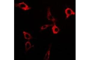 Immunofluorescent analysis of PDC-E2 staining in Hela cells. (DLAT anticorps)