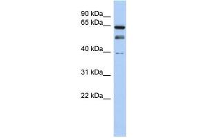 WB Suggested Anti-MYST2 Antibody Titration: 0. (MYST2 anticorps  (N-Term))