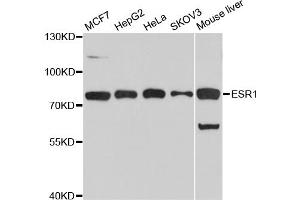 Western blot analysis of extracts of various cell lines, using ESR1 antibody (ABIN5970121) at 1/1000 dilution. (Estrogen Receptor alpha anticorps)