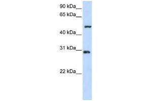 Western Blot showing ZNF138 antibody used at a concentration of 1-2 ug/ml to detect its target protein. (ZNF138 anticorps  (N-Term))
