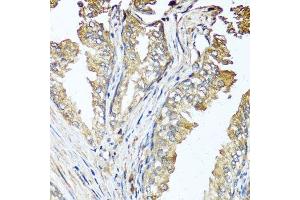Immunohistochemistry of paraffin-embedded human prostate using STK3 antibody. (STK3 anticorps  (AA 323-450))
