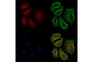 ABIN6261044 and ABIN6279645 staining Hela cells by IF/ICC.