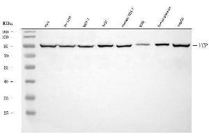 Western blot analysis of VCP using anti-VCP antibody (ABIN7599605).