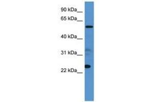 Image no. 1 for anti-Copine IX (CPNE9) (AA 359-408) antibody (ABIN6746107) (CPNE9 anticorps  (AA 359-408))