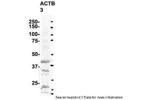 Sample Type: 3. (GAPDH anticorps  (N-Term))