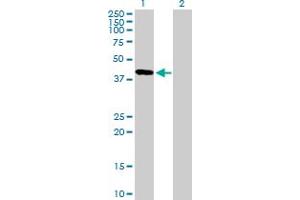 Western Blot analysis of FBXO31 expression in transfected 293T cell line by FBXO31 MaxPab polyclonal antibody. (FBXO31 anticorps  (AA 1-367))