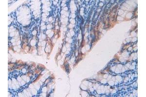 Used in DAB staining on fromalin fixed paraffin- embedded stomach tissue (FBLN4 anticorps  (AA 182-431))