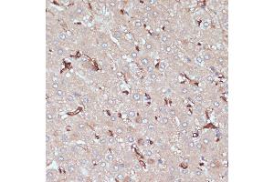 Immunohistochemistry of paraffin-embedded human liver using HLA-DRA antibody (ABIN6131757, ABIN6141827, ABIN6141829 and ABIN6215475) at dilution of 1:100 (40x lens).