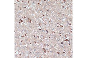 Immunohistochemistry of paraffin-embedded human liver using HLA-DRA antibody (ABIN6131757, ABIN6141827, ABIN6141829 and ABIN6215475) at dilution of 1:100 (40x lens). (HLA-DRA anticorps  (AA 26-216))