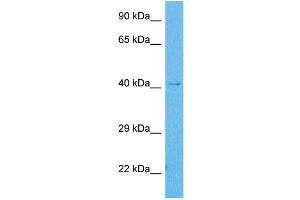 Host:  Rabbit  Target Name:  SLC10A1  Sample Tissue:  Human Jurkat Whole Cell  Antibody Dilution:  1ug/ml