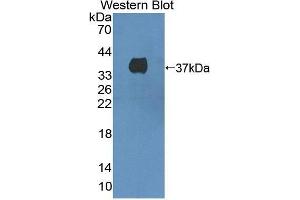 Western Blotting (WB) image for anti-Met Proto-Oncogene (MET) (AA 1092-1379) antibody (ABIN1868365)