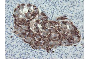 Immunohistochemistry (IHC) image for anti-Plasminogen Activator Inhibitor 1 (SERPINE1) antibody (ABIN1499717)