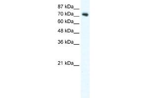 WB Suggested Anti-DVL1 Antibody Titration:  2. (DVL1 anticorps  (C-Term))