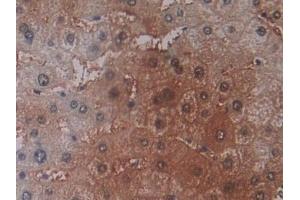 Detection of PEBP1 in Human Liver Tissue using Polyclonal Antibody to Phosphatidylethanolamine Binding Protein 1 (PEBP1) (PEBP1 anticorps  (AA 2-187))