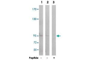 Western blot analysis of extracts from Jurkat cells (Lane 1) and COLO cells (Lane 2 and 3), using GRIA1 polyclonal antibody . (Glutamate Receptor 1 anticorps)