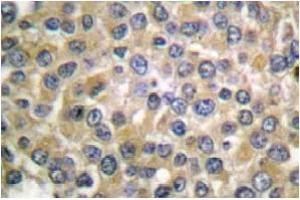 Image no. 1 for anti-Melan A (MLANA) antibody (ABIN265512) (MLANA anticorps)