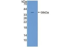 Detection of Recombinant TPP1, Human using Polyclonal Antibody to Tripeptidyl Peptidase I (TPP1)