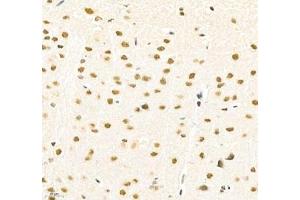 Immunohistochemistry of paraffin embedded rat brain using PABPN1 (ABIN7075116) at dilution of 1:600 (400x lens) (PABPN1 anticorps)