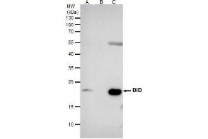 IP Image Bid antibody [N1C3] immunoprecipitates BID protein in IP experiments. (BID anticorps)